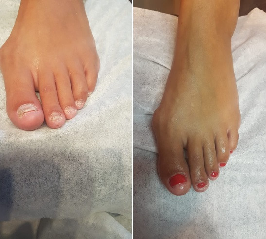 photo - Pedicuresalon Sensa
