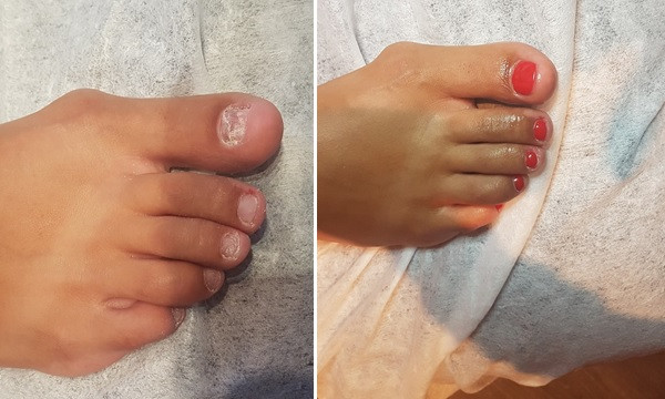 photo - Pedicuresalon Sensa